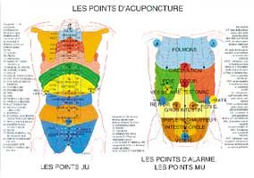 Poster plastifié Points d'acupuncture (A2)